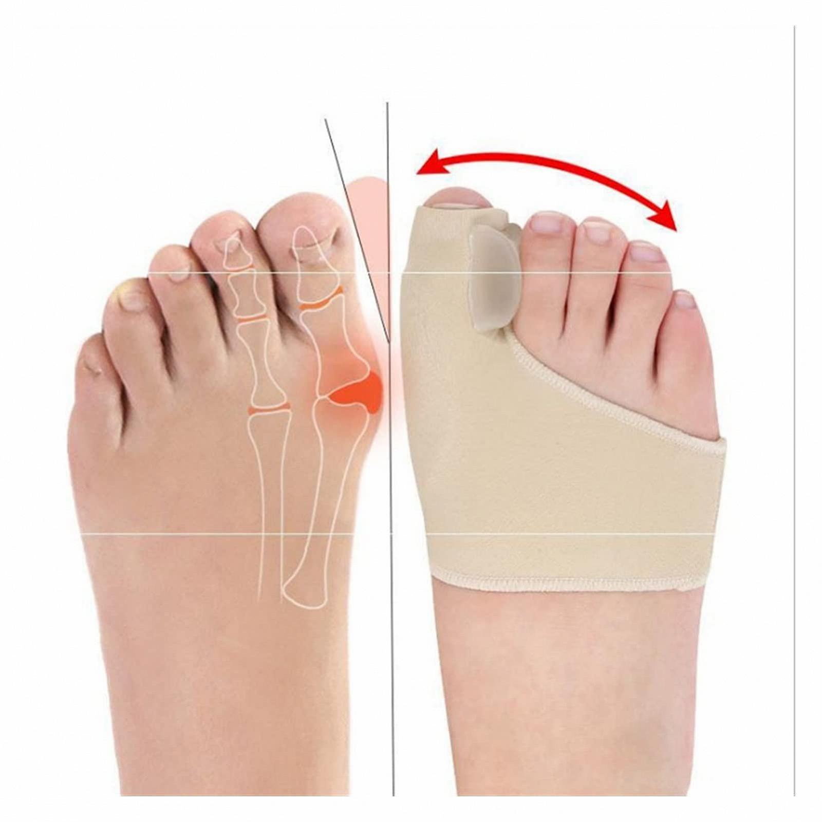 Роздільник для пальців ніг Hallux Valgus, коректор кісточки великого пальця, фото №2 Роздільник для пальців ніг Hallux Valgus, коректор кісточки великого пальця, фото №2