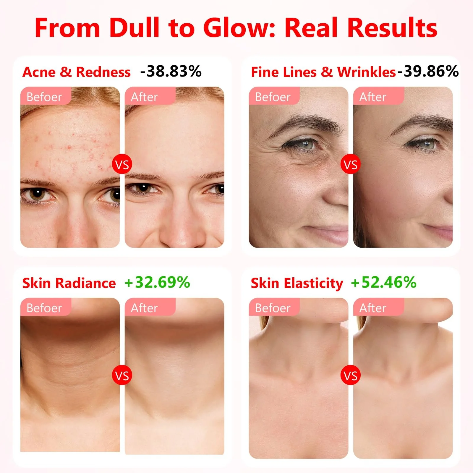 LED Маска для обличчя USUIELIGHT 7 Colours Світлова терапія, Червоне світло для анти-старіння, акне та підтяжки шкіри, фото №3