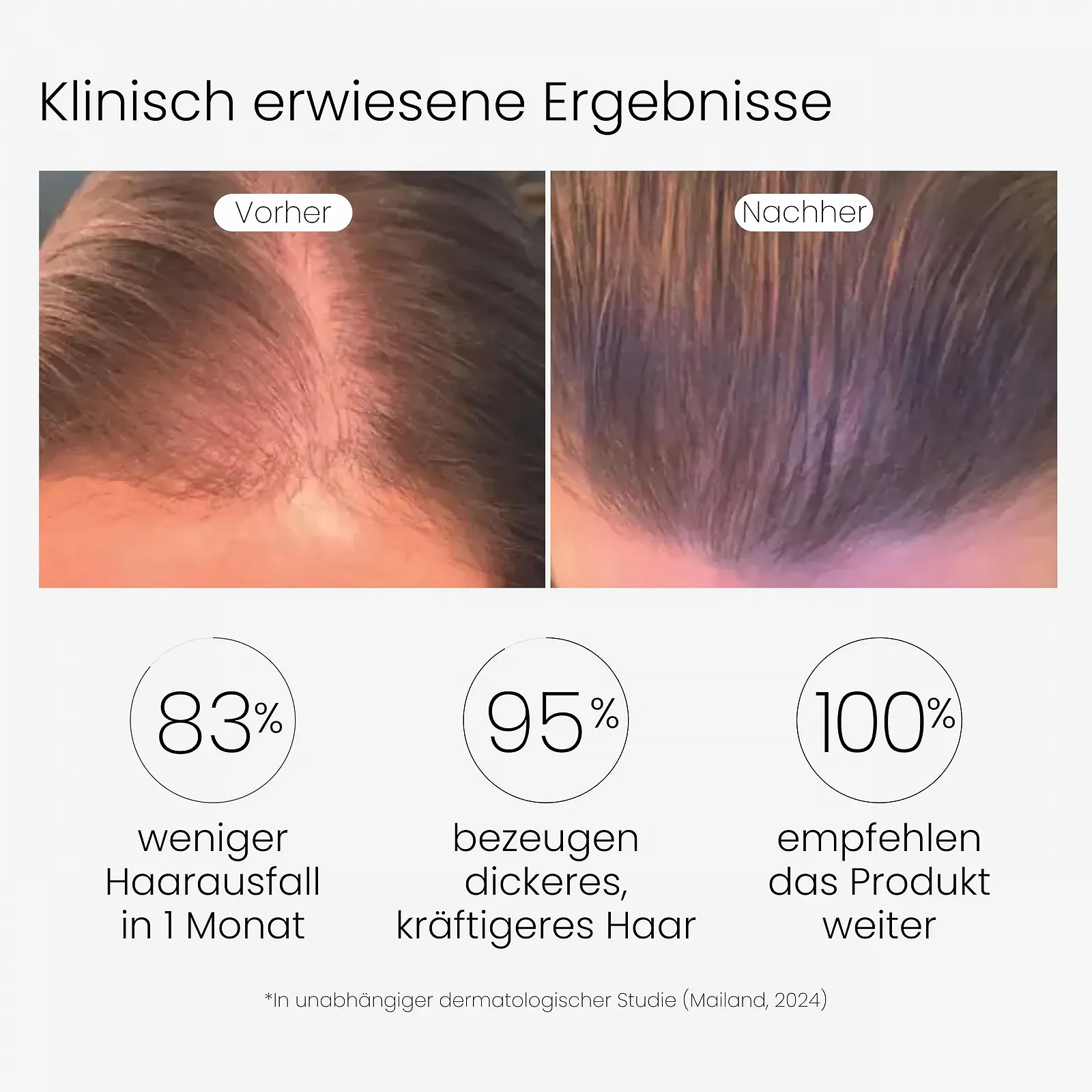 Еліксир для шкіри голови VEDIC LAB Energizing Day + UV (100 мл) Сироватка проти випадіння волосся з аюрведичними травами, фото №3