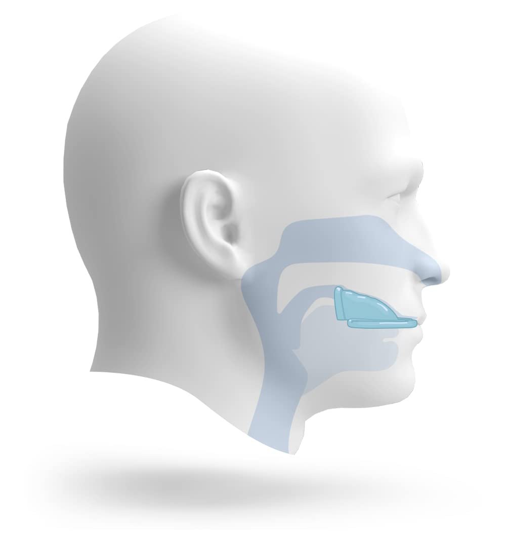 Тренажер для піднебіння проти хропіння GAUMFIT, 30 хвилин щоденних тренувань, для спокійного сну, зроблено в Німеччині, фото №4 Тренажер для піднебіння проти хропіння GAUMFIT, 30 хвилин щоденних тренувань, для спокійного сну, зроблено в Німеччині, фото №4