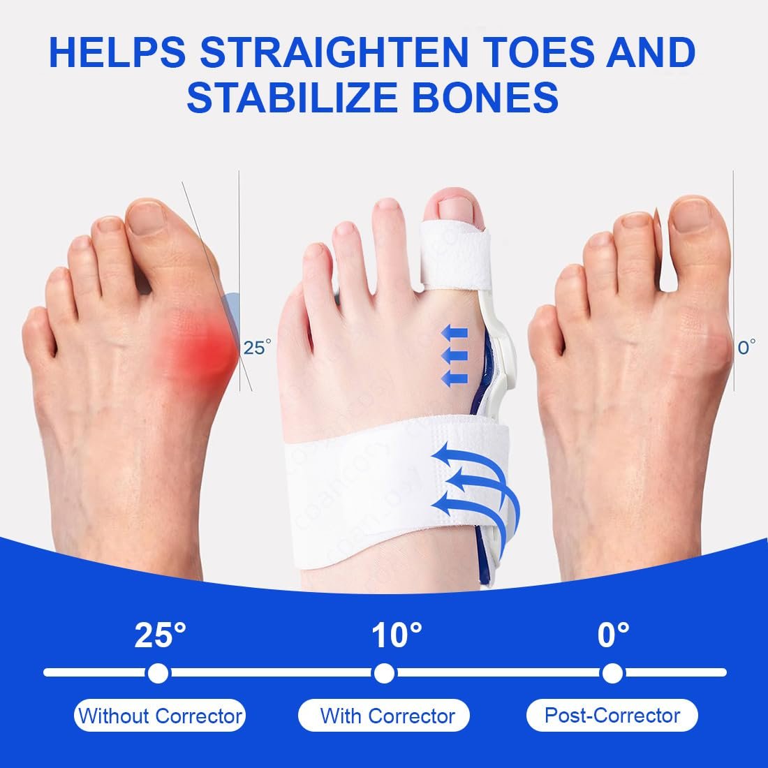 Шкарпетки для корекції Hallux Valgus 2 шт. Регульовані, фото №4
