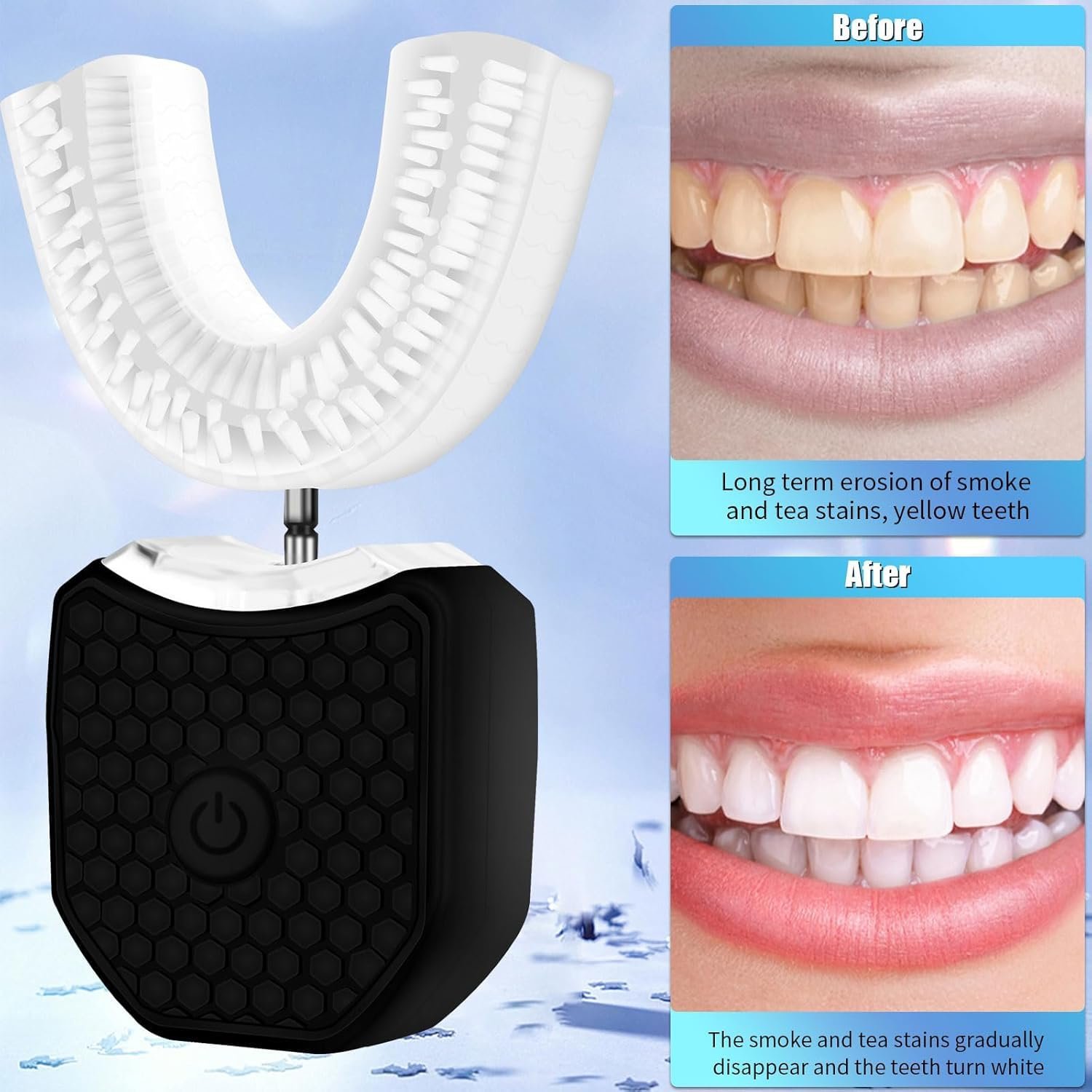 Електрична ультразвукова зубна щітка WingFly U-подібна 360° бездротова Black, M, фото №8