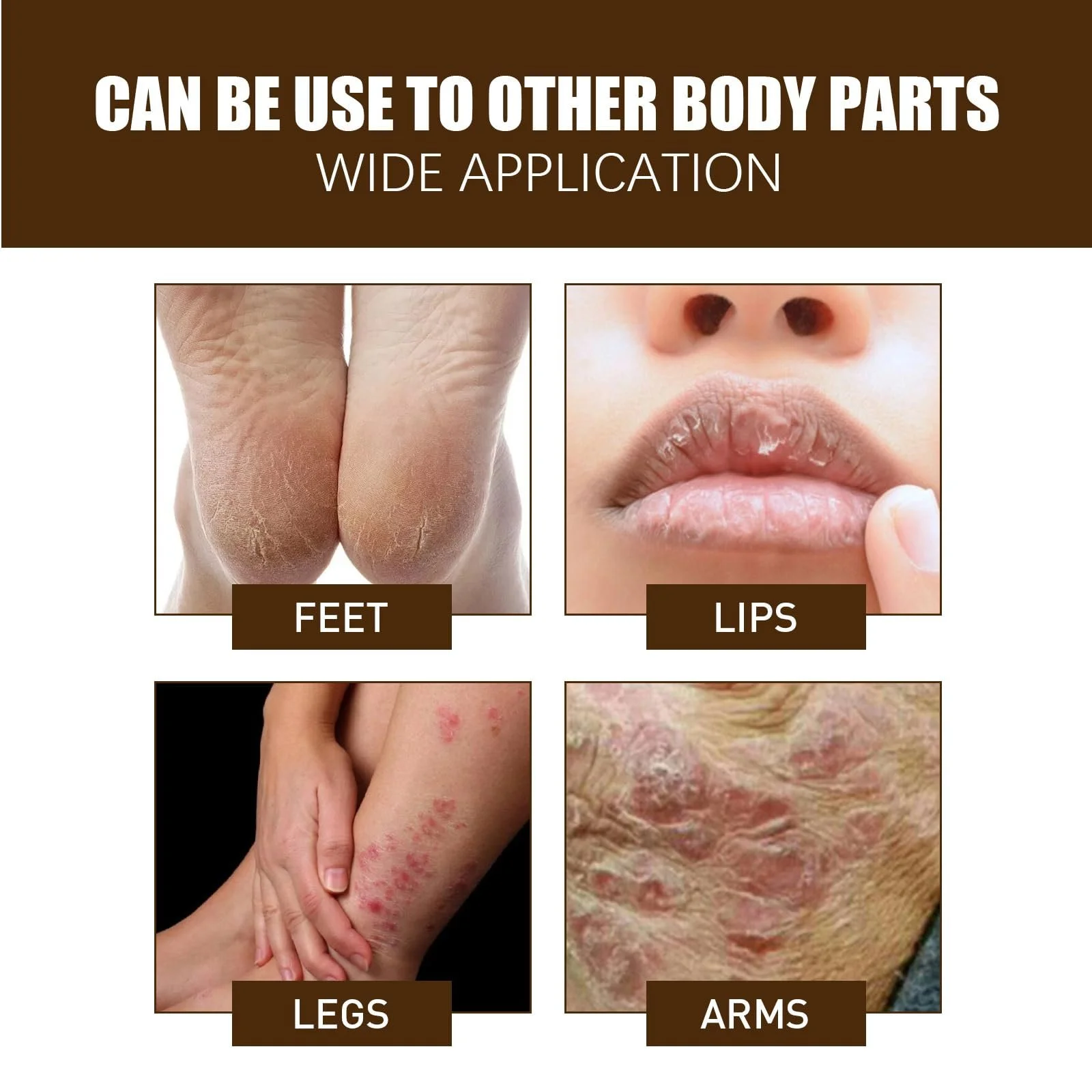 Крем для ног Moisturising and Anti-Cracks для очень сухой кожи, фото №6