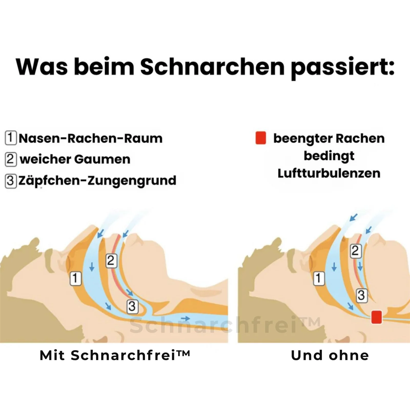Клипса против храпа Pomera Многофункциональная, фото №3 Клипса против храпа Pomera Многофункциональная, фото №3
