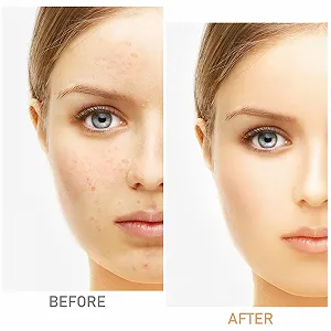 Крем-консилер Boobeen Полное покрытие Натуральный Бежевый synthetic.ua - Фото 1