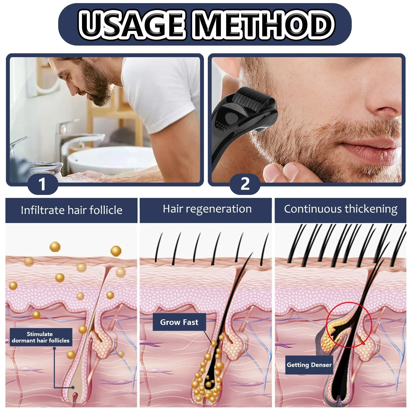 Дермаролер WhaleO Набір для росту бороди 0.5 мм, 1 мм, 1.5 мм, 2 мм з 540 титановими мікроголками, фото №4