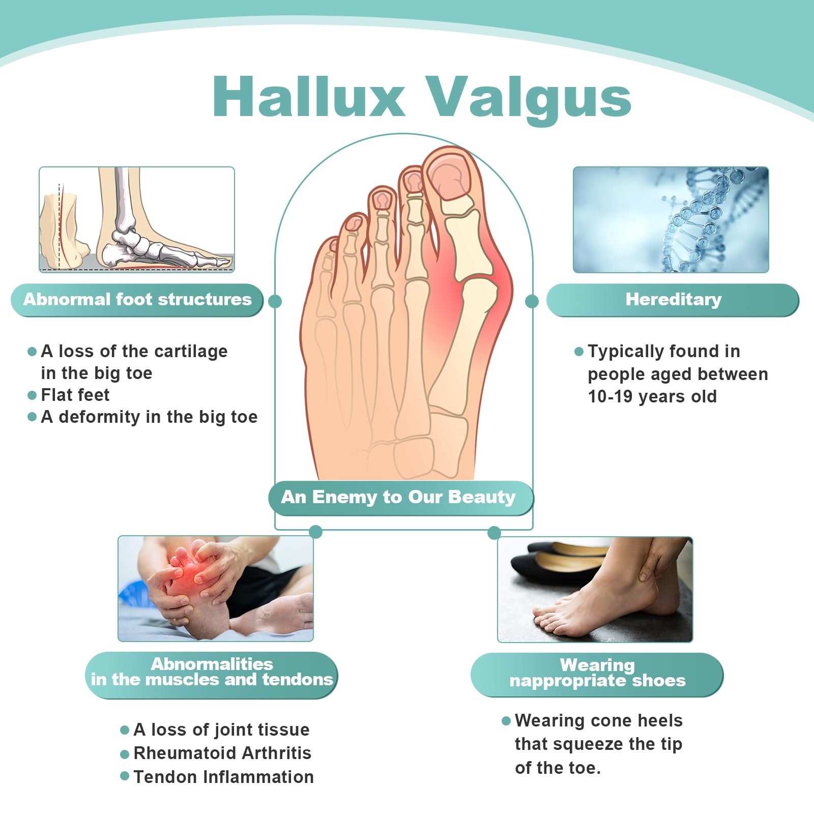 Ортез Hallux Valgus Захист для пальців ніг Hallux Valgus, фото №2 Ортез Hallux Valgus Захист для пальців ніг Hallux Valgus, фото №2