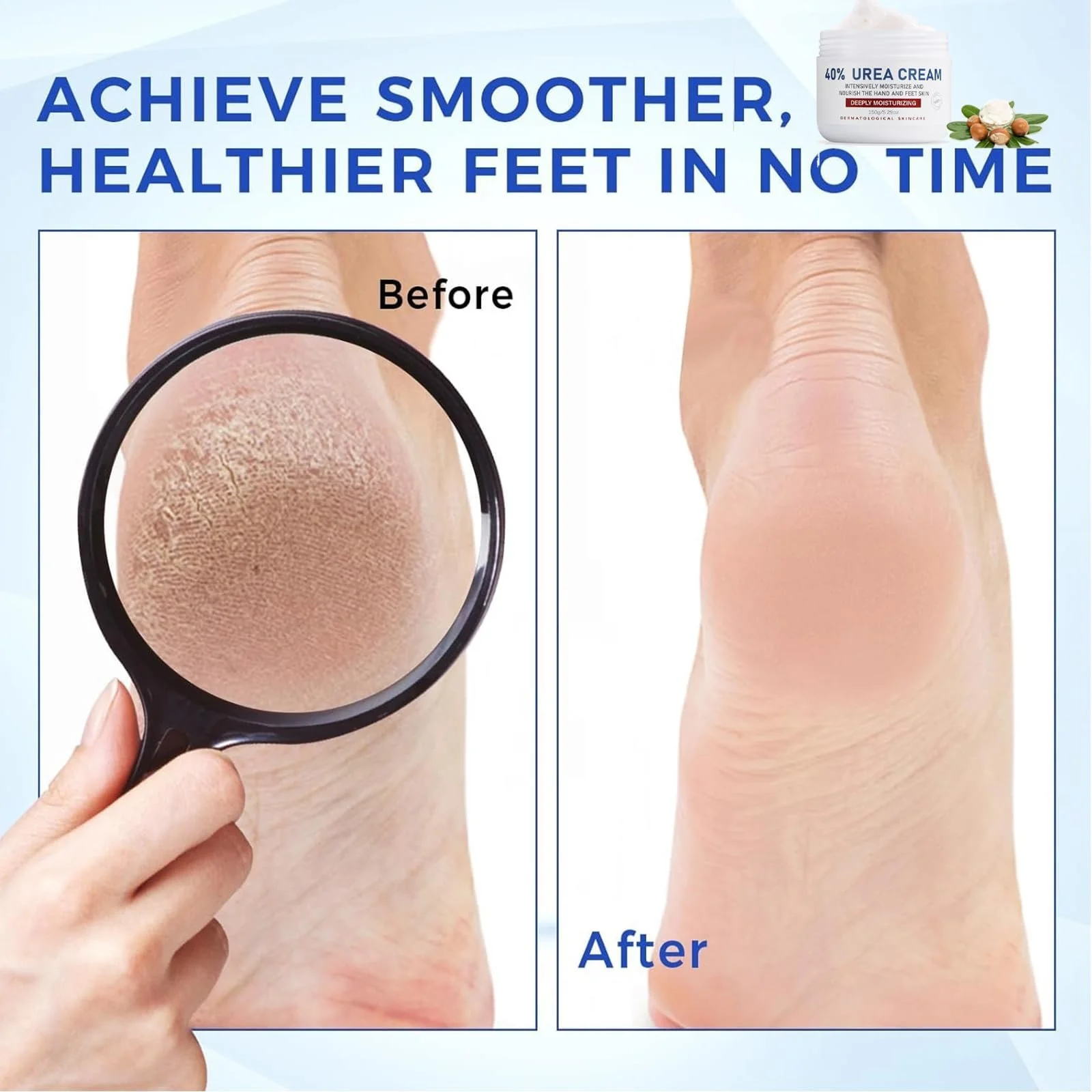 Крем для ног Urea Cream 40% Anti Callus Maximum Strength 150 г, фото №5