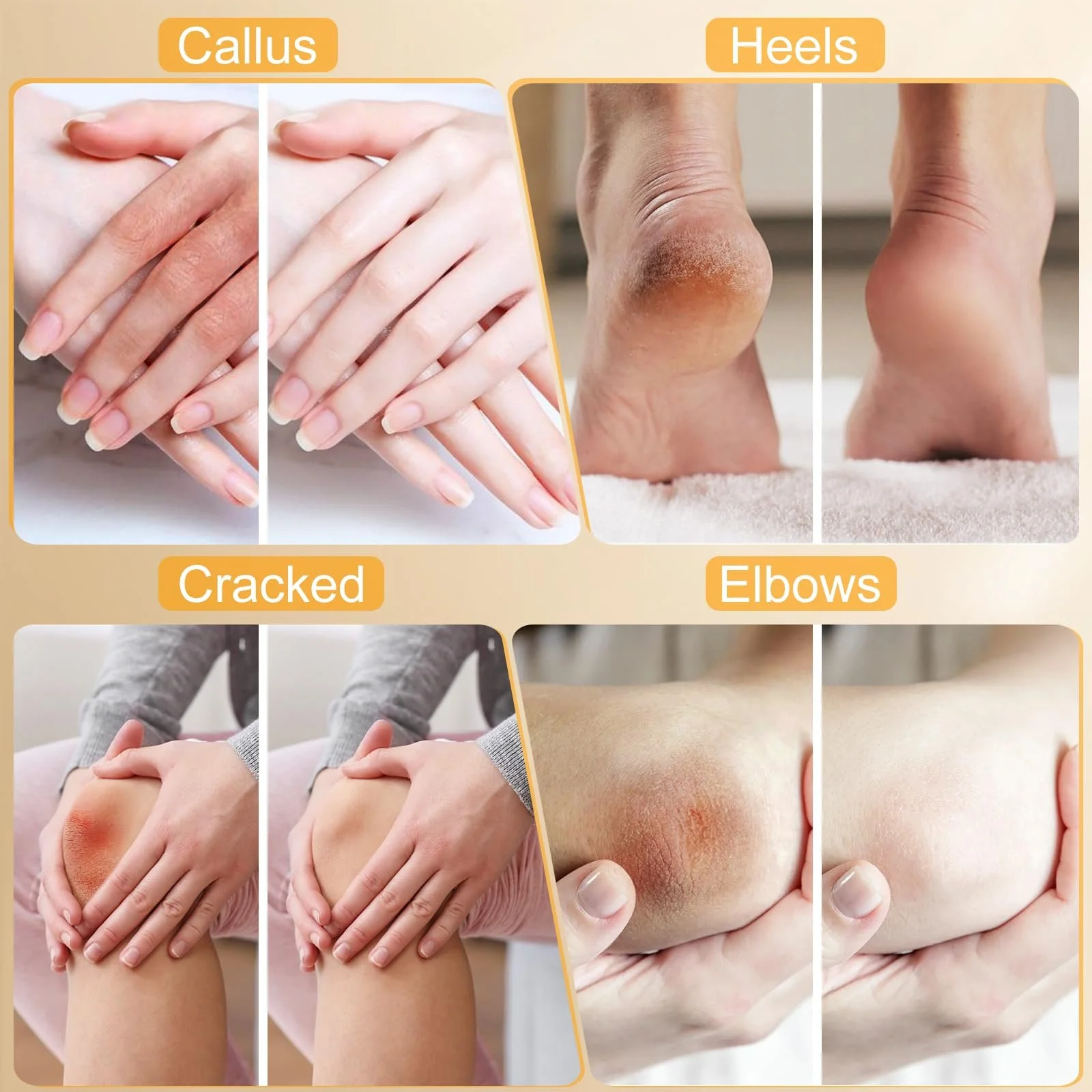 Набор кремов для ног Urea Cream 40%, 42% Plus 2% Salicylic Acid для сухих пяток и мозолей, фото №4