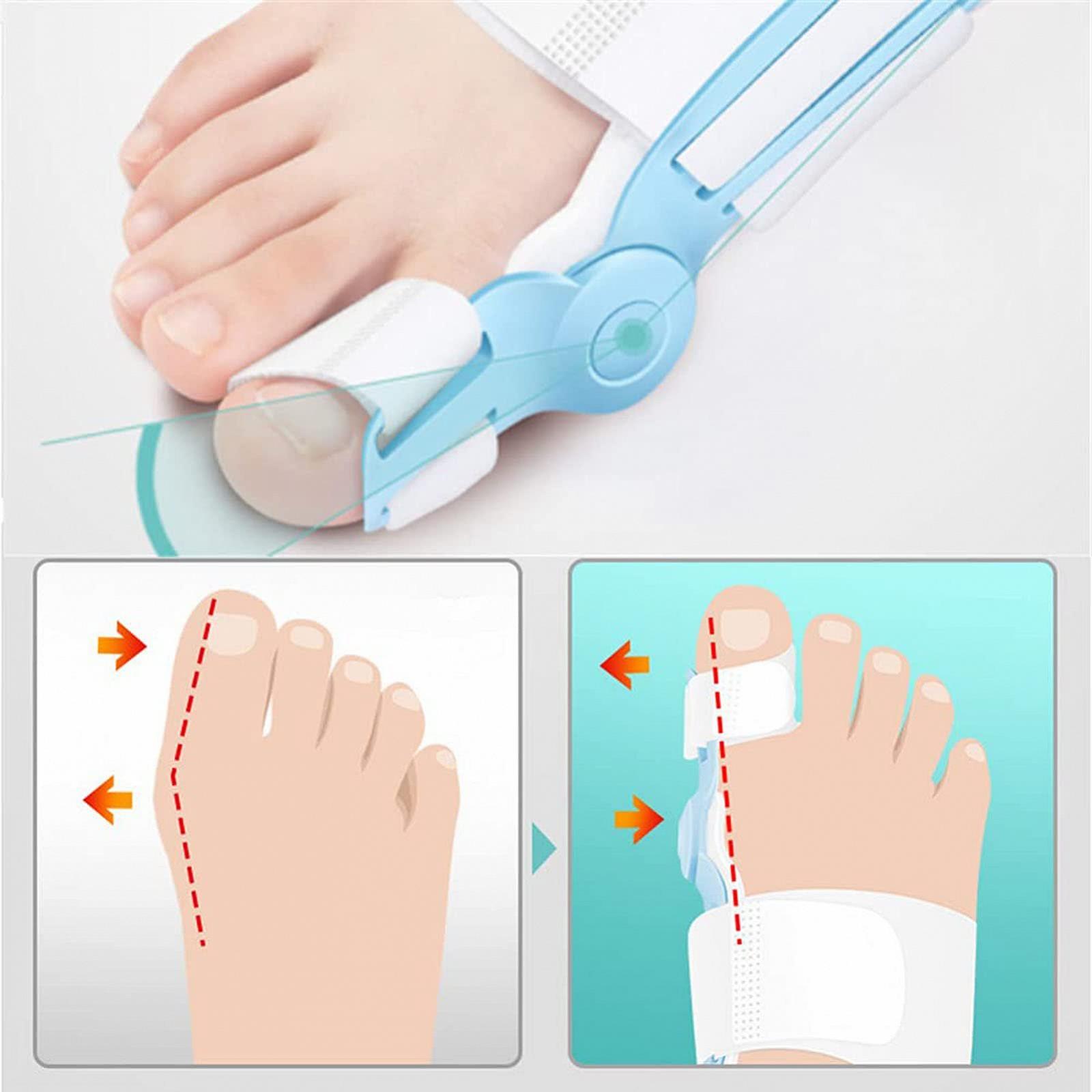 Бандаж для великого пальця стопи, Коректор для випрямлення великих пальців ніг з тренувальним поясом, фото №4