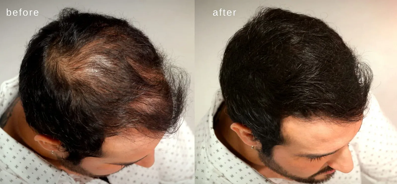 Волокна для волосся Maxx Pro Series Volumising з справжнім кератином для тонкого волосся/випадіння волосся, фото №3