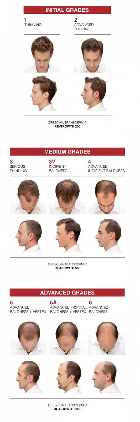 Ампули CRESCINA HFSC TRANSDERMIC technology комплекс для відновлення росту волосся та проти випадіння для чоловіків 1300 N 10+10, фото №5