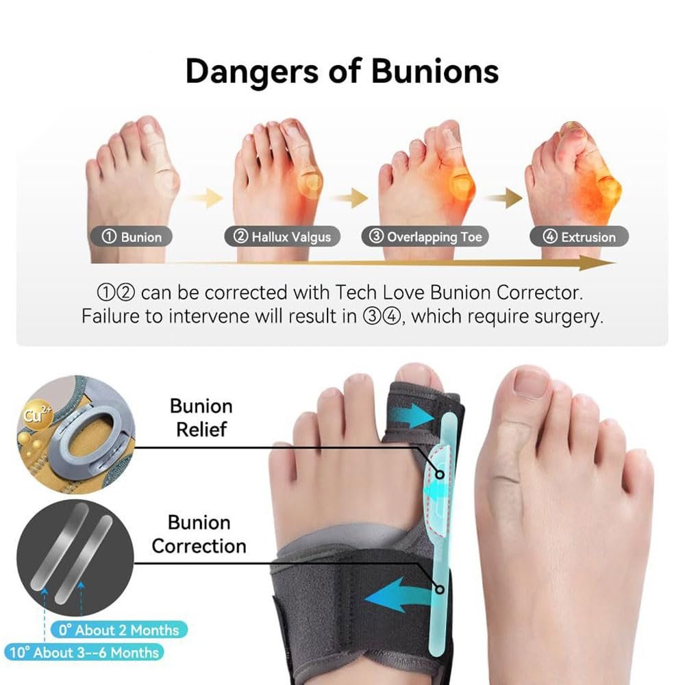 Коректор Вальгусної Деформації Hallux Valgus Роздільник Пальців з Захисною Подушечкою та Смужками Підтримки Сірий, фото №3