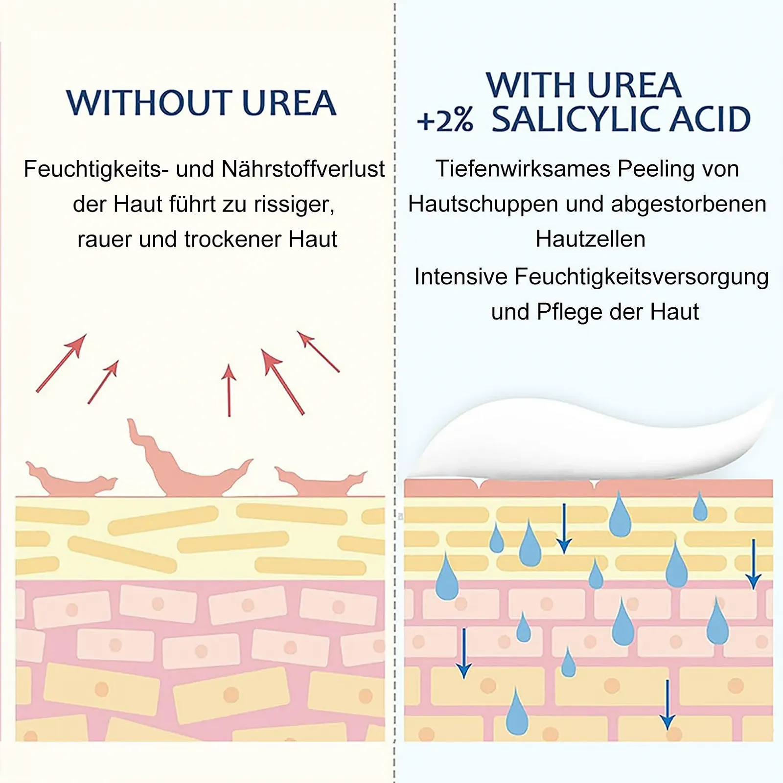 Крем для ног Urea 40 для восстановления и питания кожи, фото №8