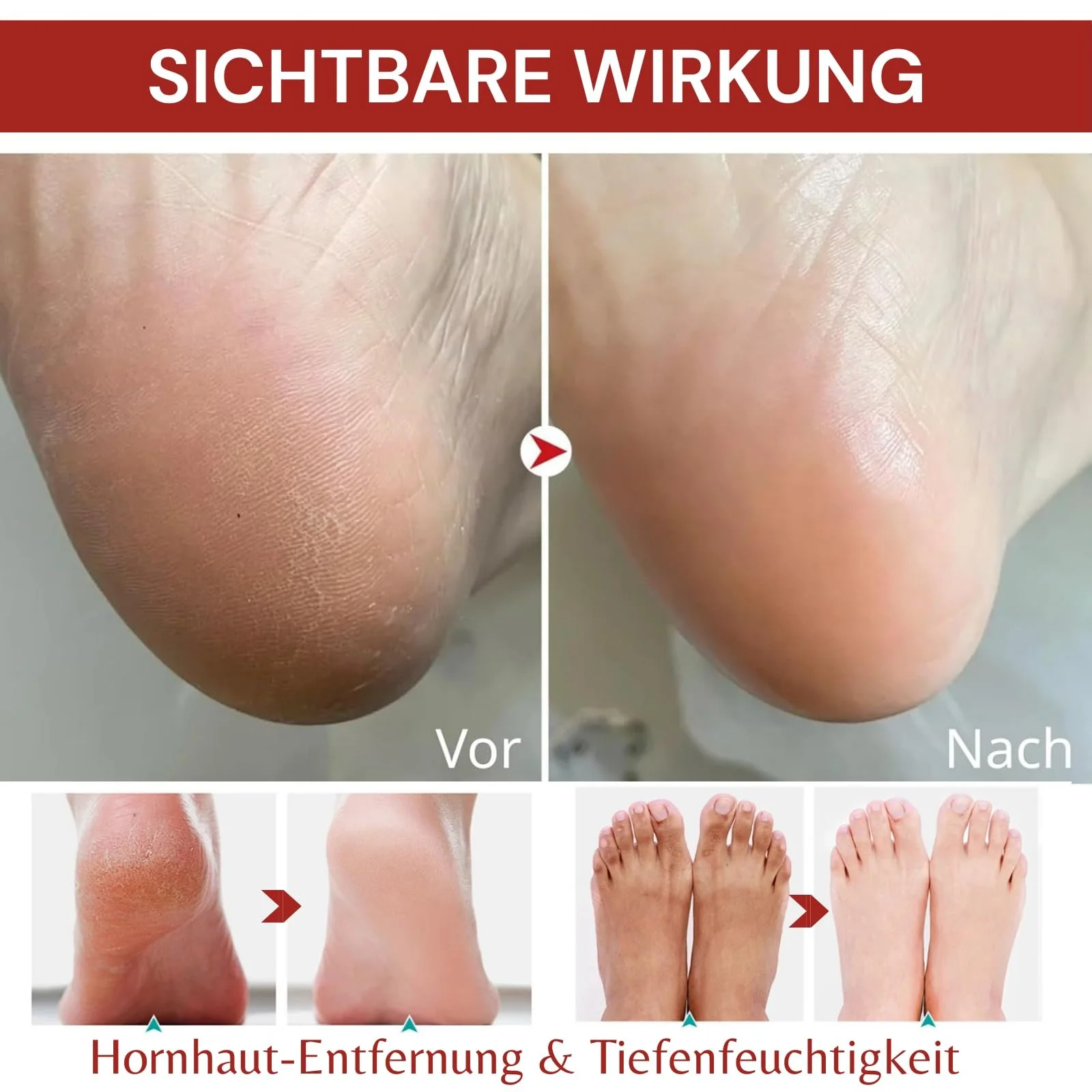 Крем-стик для ног Увлажняющий против трещин и мозолей с 60% мочевиной, фото №4