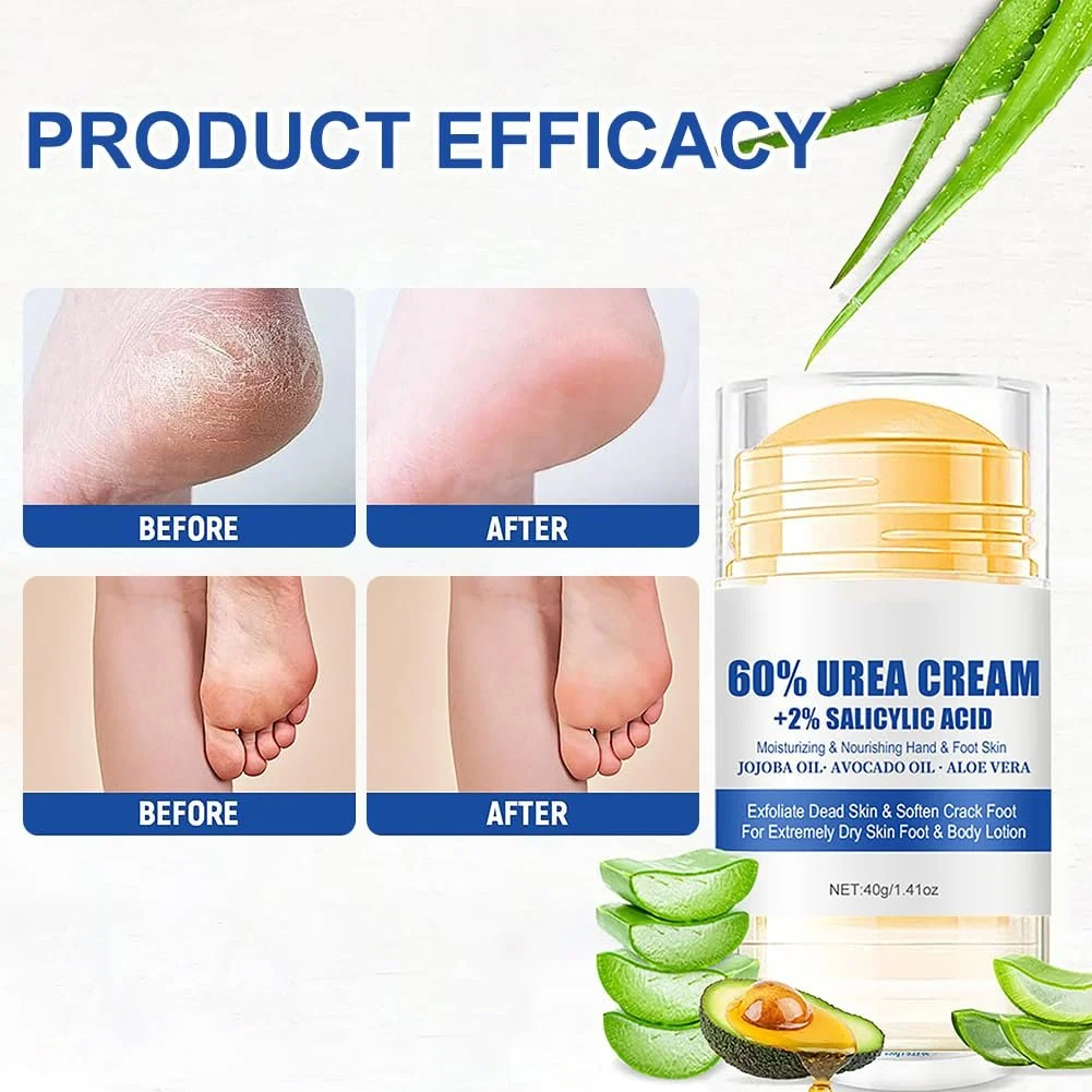 Крем для ног Urea Cream 60% Hydrating and Anti-Cracking 40 г, фото №5