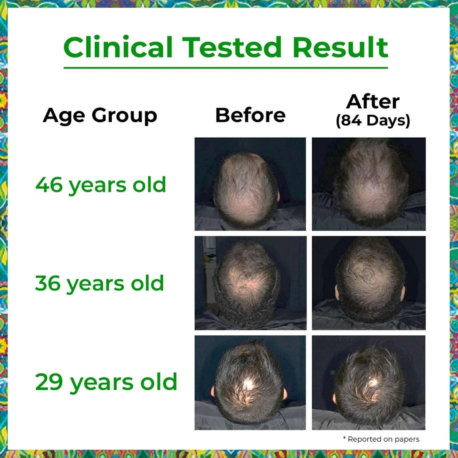 Сироватка для росту волосся Passion Indulge Advanced Для чоловіків і жінок - 50 мл, фото №4