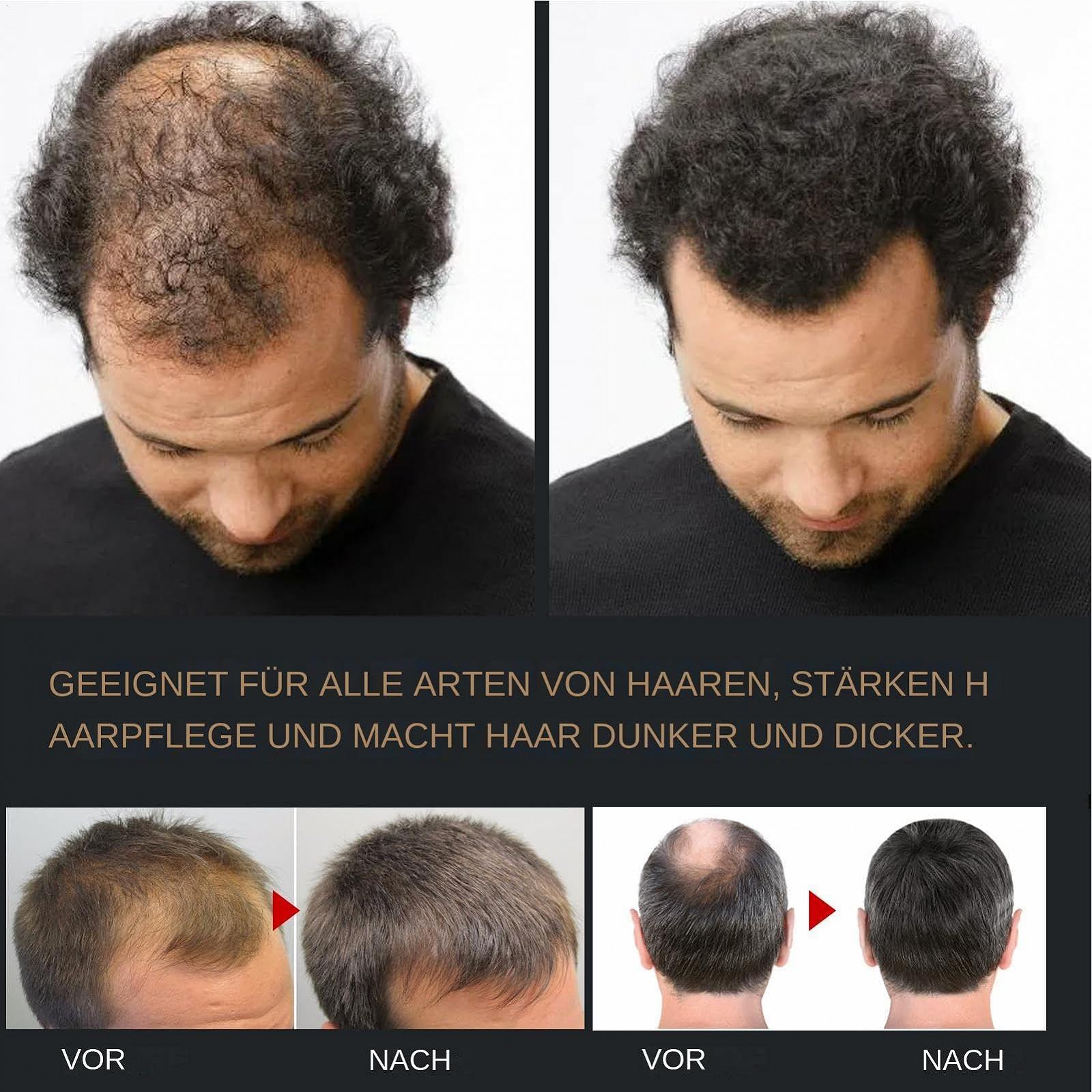 Шампунь Spartan Root Activator 2 х 100 мл Spartan проти випадіння волосся натуральний для чоловіків, фото №7 Шампунь Spartan Root Activator 2 х 100 мл Spartan проти випадіння волосся натуральний для чоловіків, фото №7