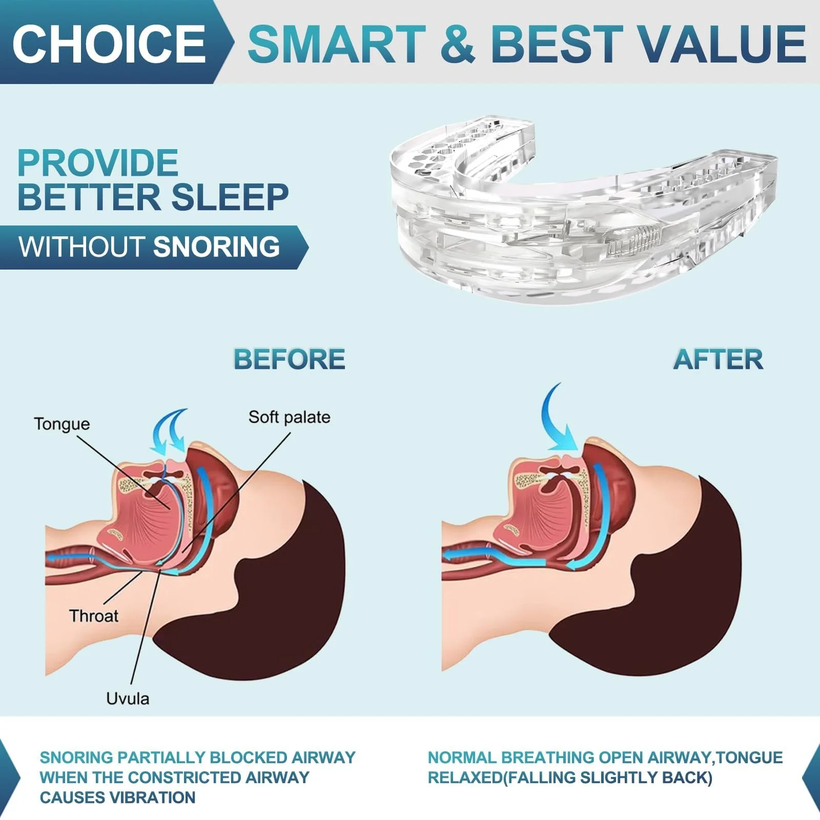 Капа от храпа и бруксизма для сна, улучшает качество сна, белая., фото №2