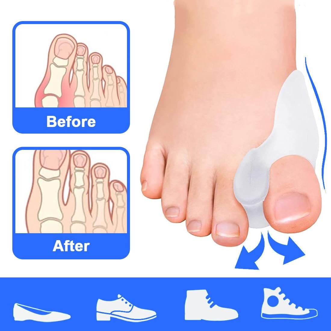 Коректор великого пальця стопи TISCH Hallux Valgus для чоловіків і жінок, покращена версія з регульованою шиною, фото №4