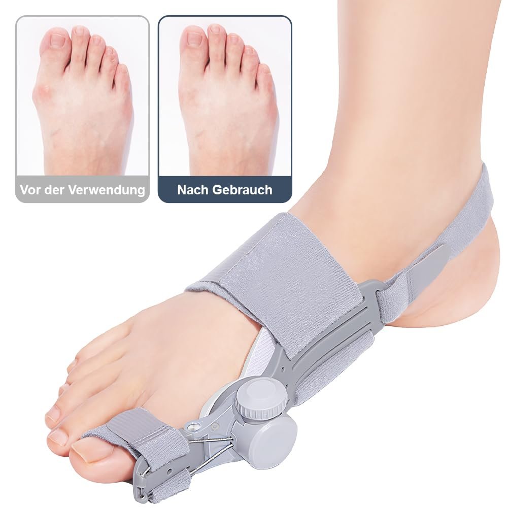 Шина для корекції Hallux Valgus Регульована з нековзним ремінцем на п'яті для корекції вальгусної деформації, фото №6