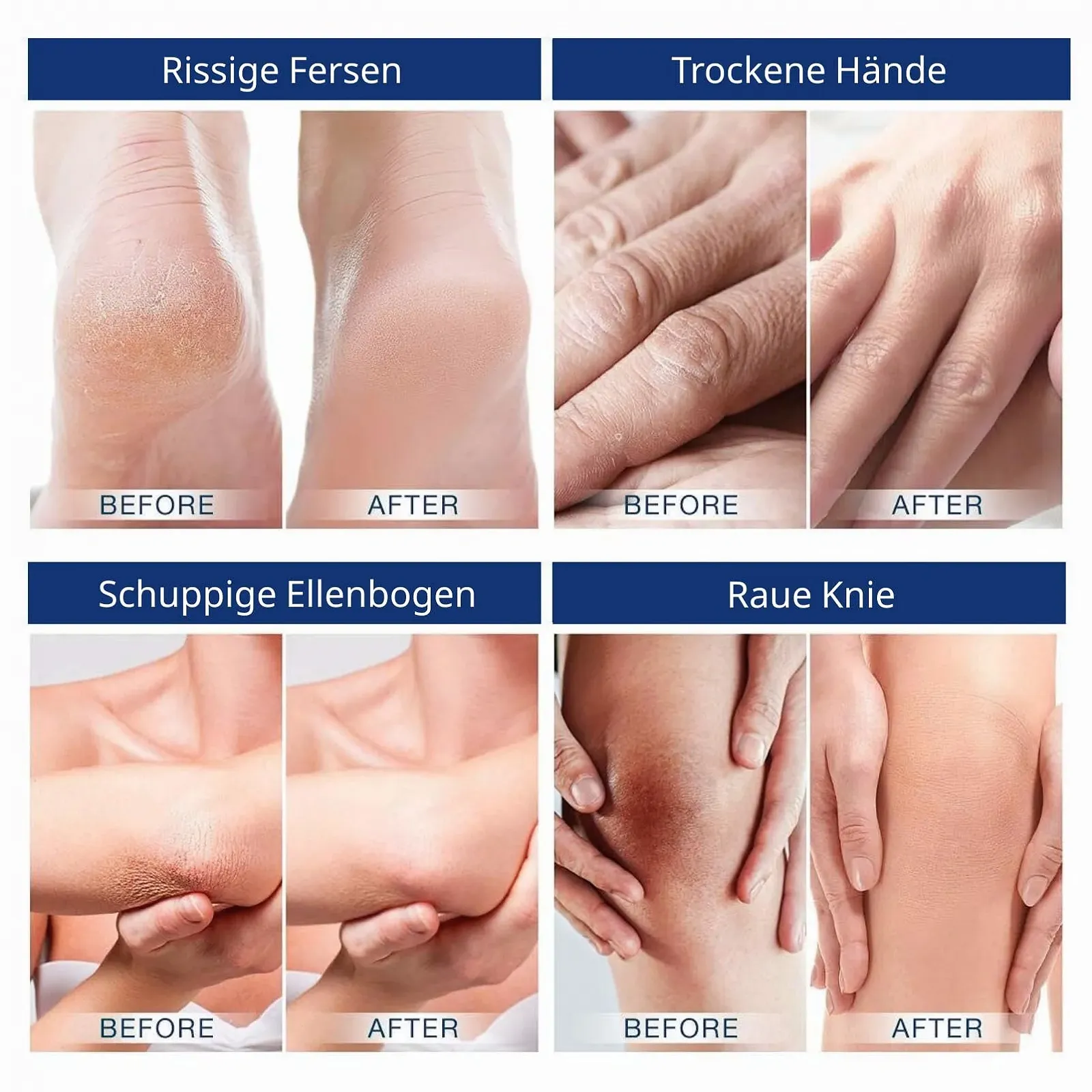 Крем для ног 60% Urea, фото №5