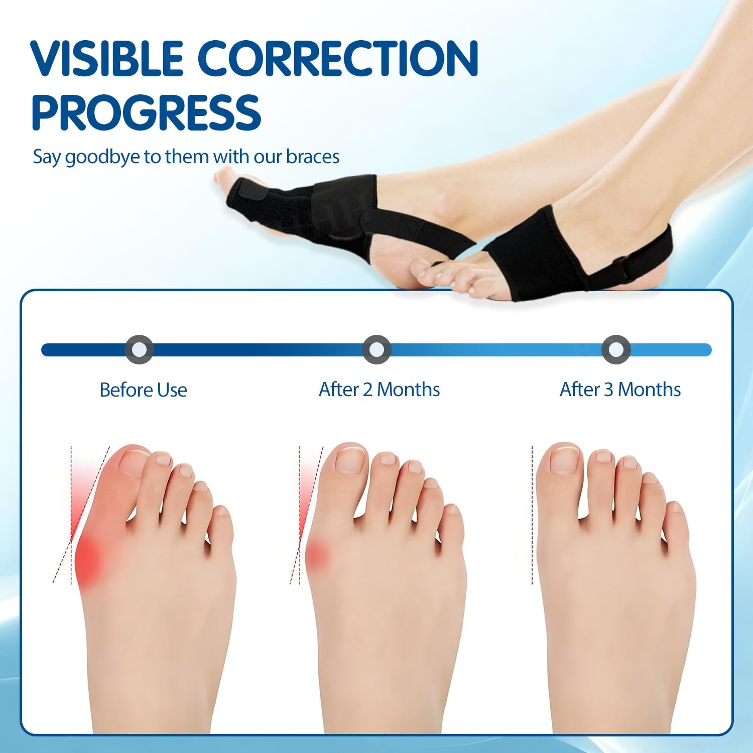 Шина для коррекции Hallux Valgus Регулируемая шина для большого пальца стопы для дня и ночи Универсальный размер для мужчин и женщин Черный Правый, фото №6