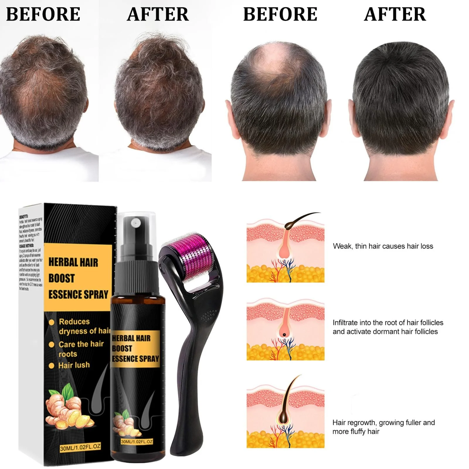 Набір для відновлення волосся Tkekruh Advanced 2 x 30 мл, Есенція для росту волосся, Ролик, фото №2 Набір для відновлення волосся Tkekruh Advanced 2 x 30 мл, Есенція для росту волосся, Ролик, фото №2