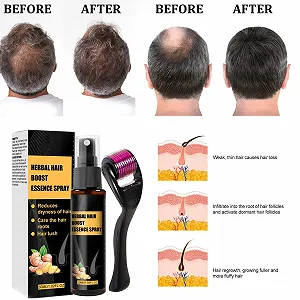 Набор для восстановления волос Tkekruh Advanced 2 x 30 мл, Эссенция для роста волос, Ролик для роста волос и набор эссенций, против выпадения волос, стимулирует рост новых волос, сыворотка synthetic.ua - Фото 1