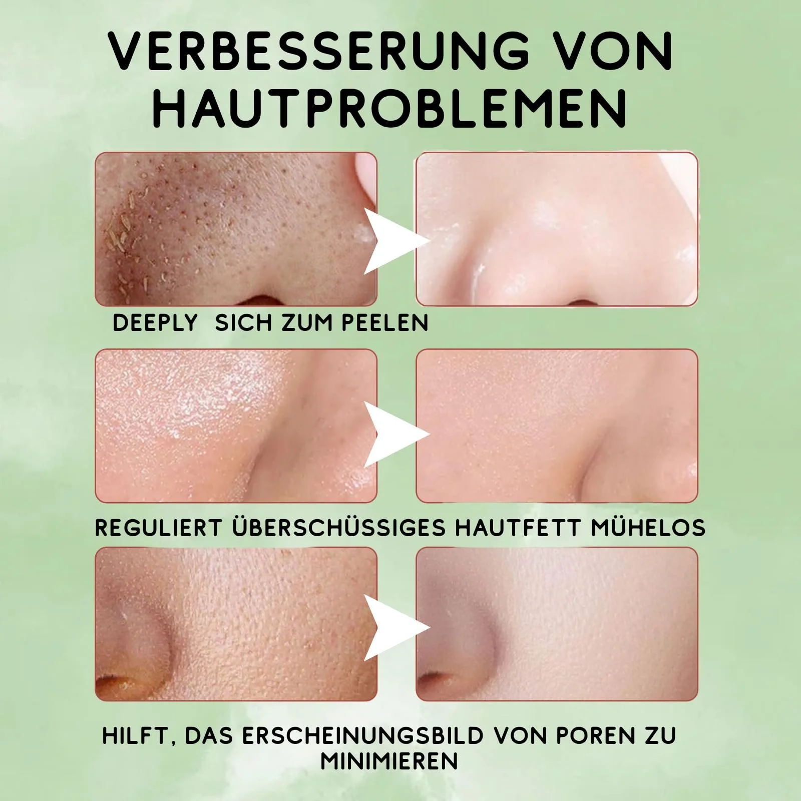 Маска-стик Зеленый Чай с повязкой Cloud Hair Band Очищающая Глубокое очищение пор и увлажнение (3 шт), фото №5