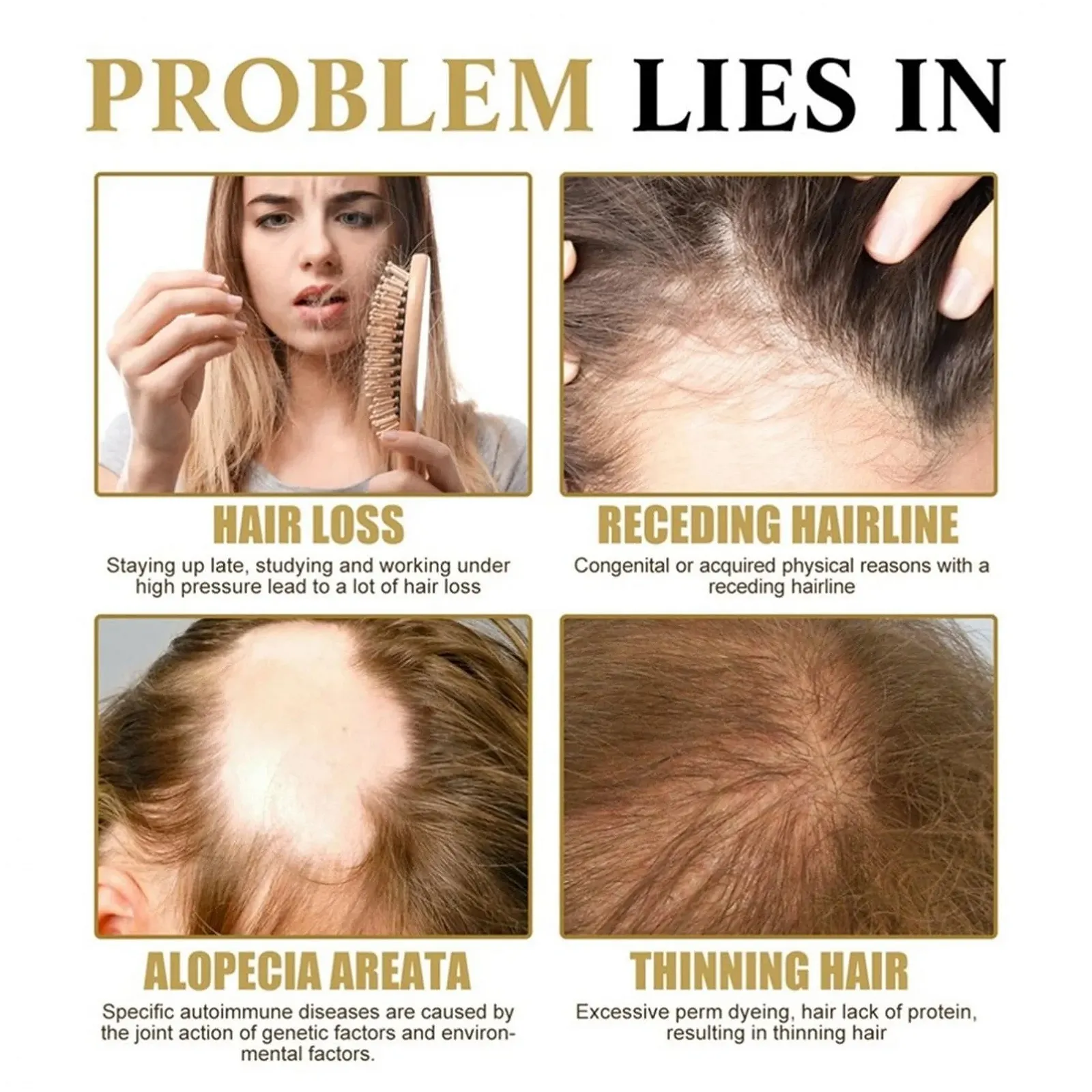 Сироватка для волосся з роликом Regrowth Organic, Засіб проти випадіння волосся, фото №3