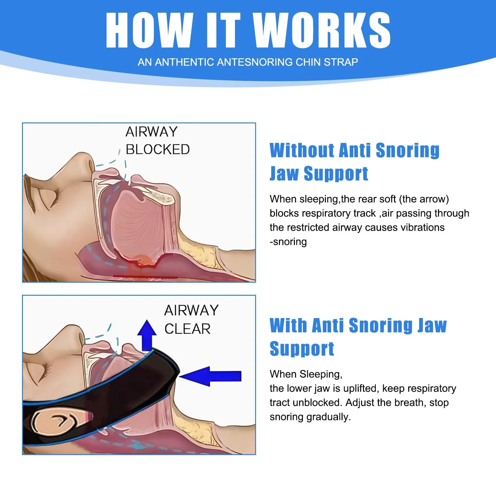 Ремінець проти хропіння, бандаж, фото №2