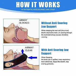 Ремешок против храпа, бандаж synthetic.ua - Фото 1