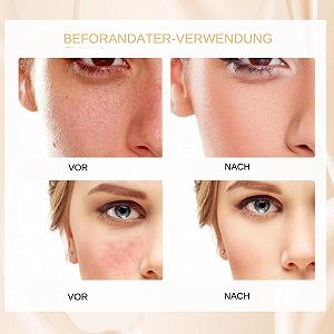 Основа Colour Changing Mature Skin Foundation Консилер Крем 30 мл Изменение Цвета Увлажняющий Водостойкий Долговечный synthetic.ua - Фото 1