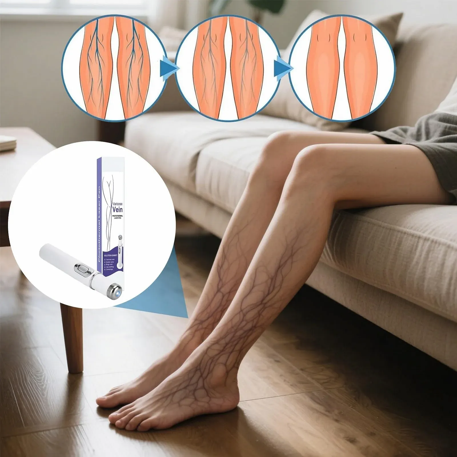 Прилад для видалення судинних зірочок Wireless Vein Care Pen для щоденного використання, фото №2