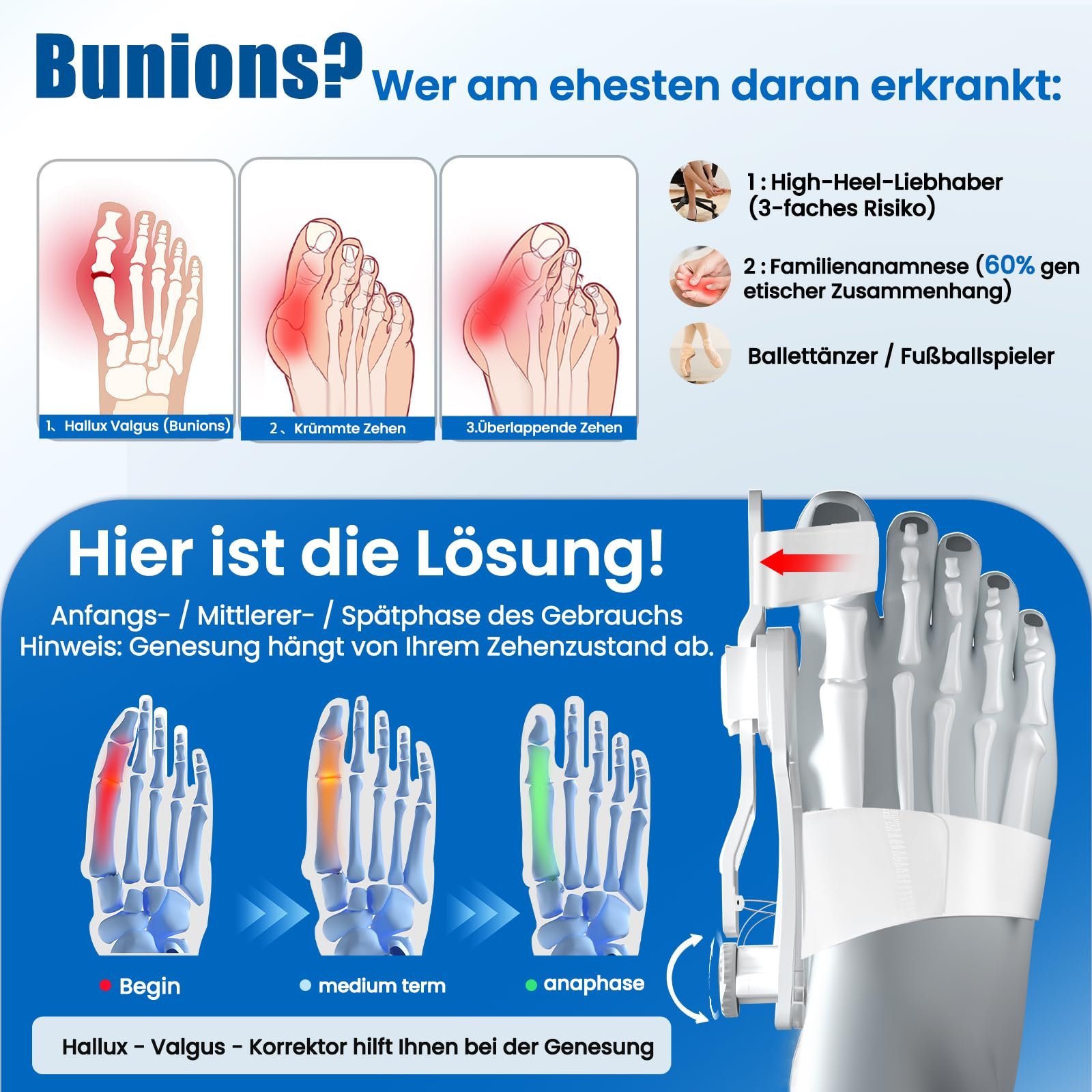 Шина для коррекции Hallux Valgus, регулируемый разделитель пальцев, шина, фото №3