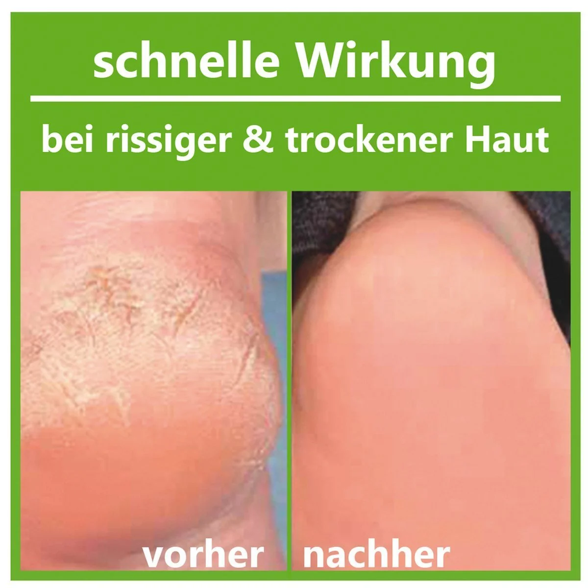 Средство для ухода за стопами и ногами с ментолом 100 мл, фото №2