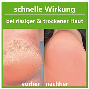 Средство для ухода за стопами и ногами с ментолом 100 мл synthetic.ua - Фото 1