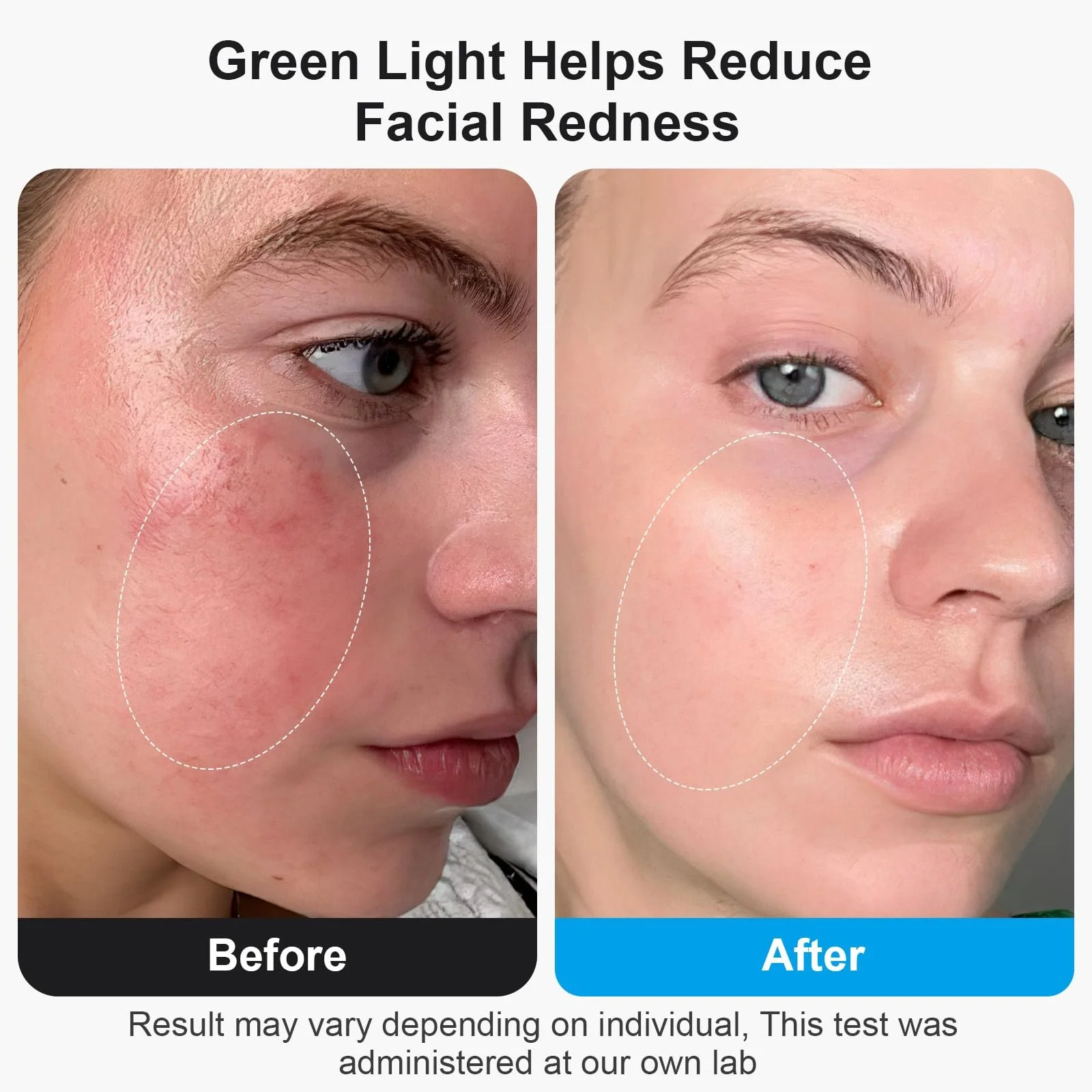 LED Маска для лица 7 цветов, Маска с красным светом, Маска для омоложения кожи лица, фото №4