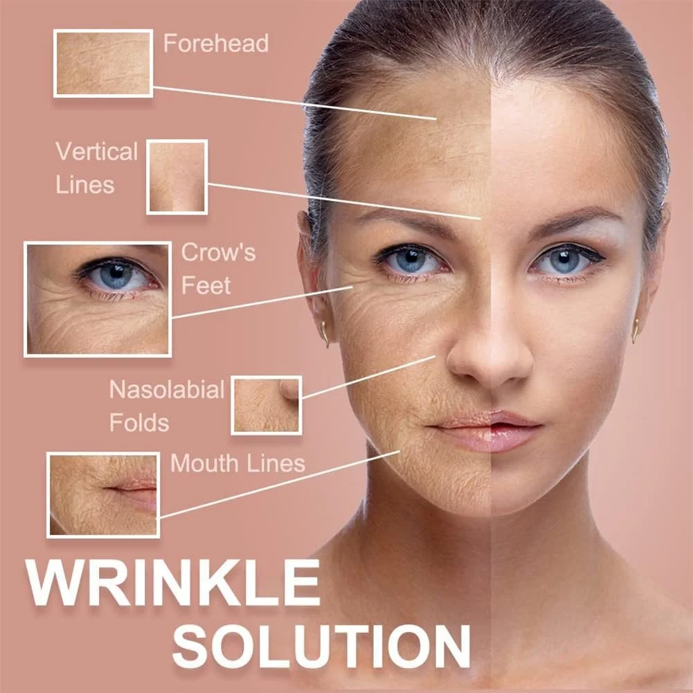 Тейп для обличчя Anti Wrinkle Plasters, Набір 2 шт, для ліфтингу обличчя, для розгладження, фото №4