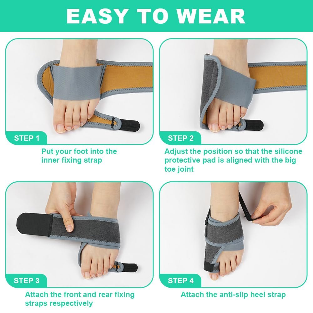 Шина для корекції Hallux Valgus Vicloon, фото №5 Шина для корекції Hallux Valgus Vicloon, фото №5