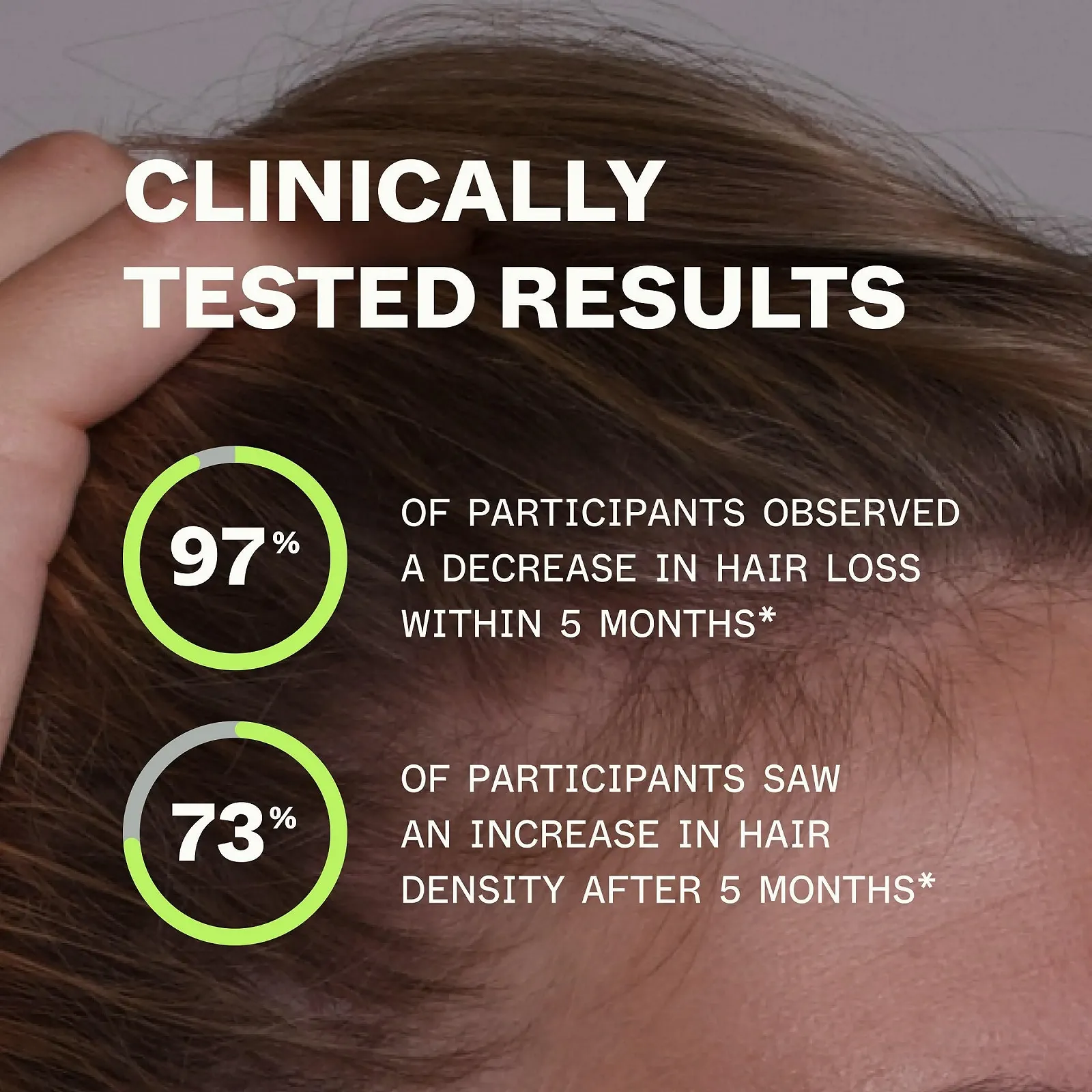 Комплекс для волосся Scandinavian Biolabs Bio-Pilixin для жінок, проти випадіння волосся, живить волосяні фолікули, фото №5