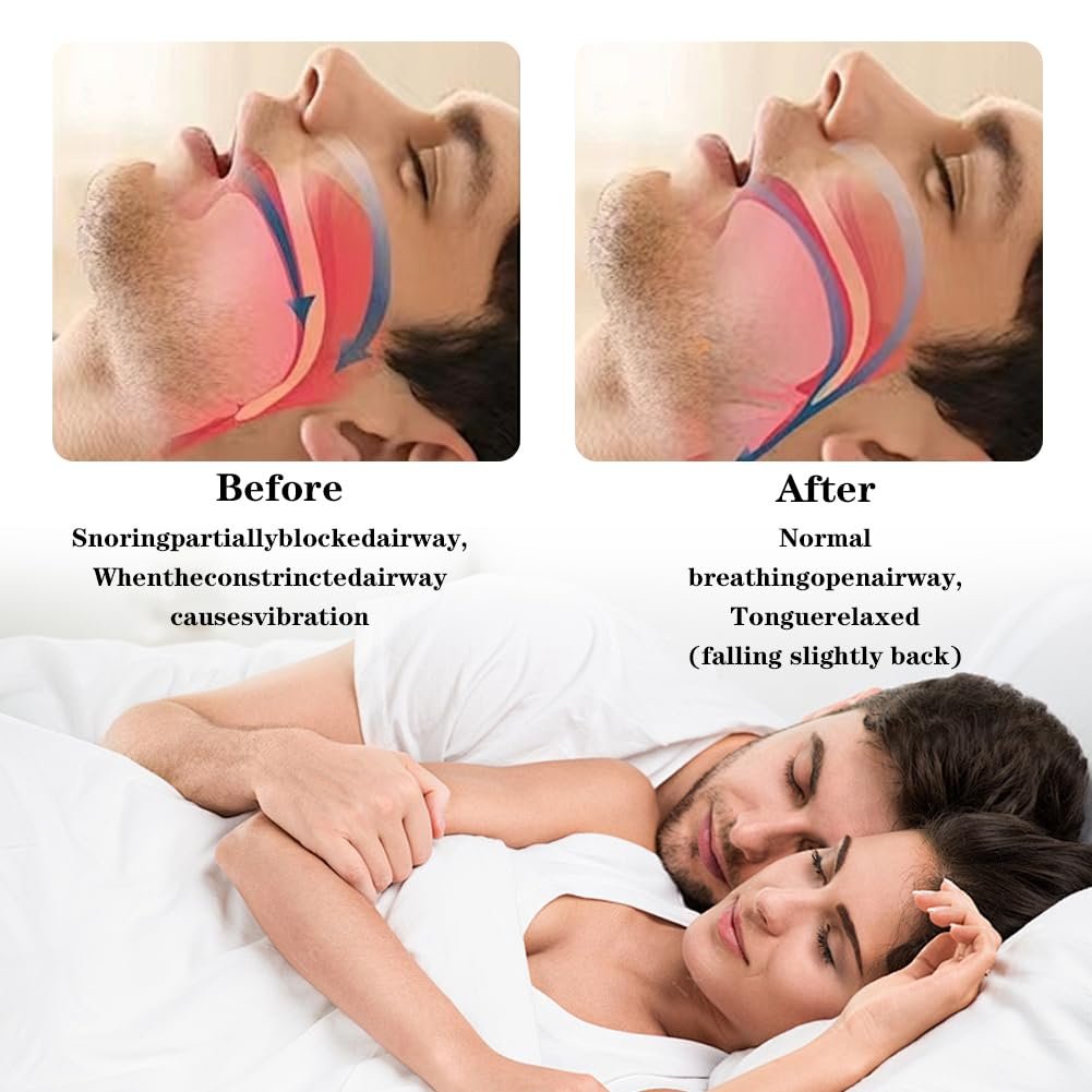 Капа от храпа Регулируемая для всех типов рта, фото №6 Капа от храпа Регулируемая для всех типов рта, фото №6