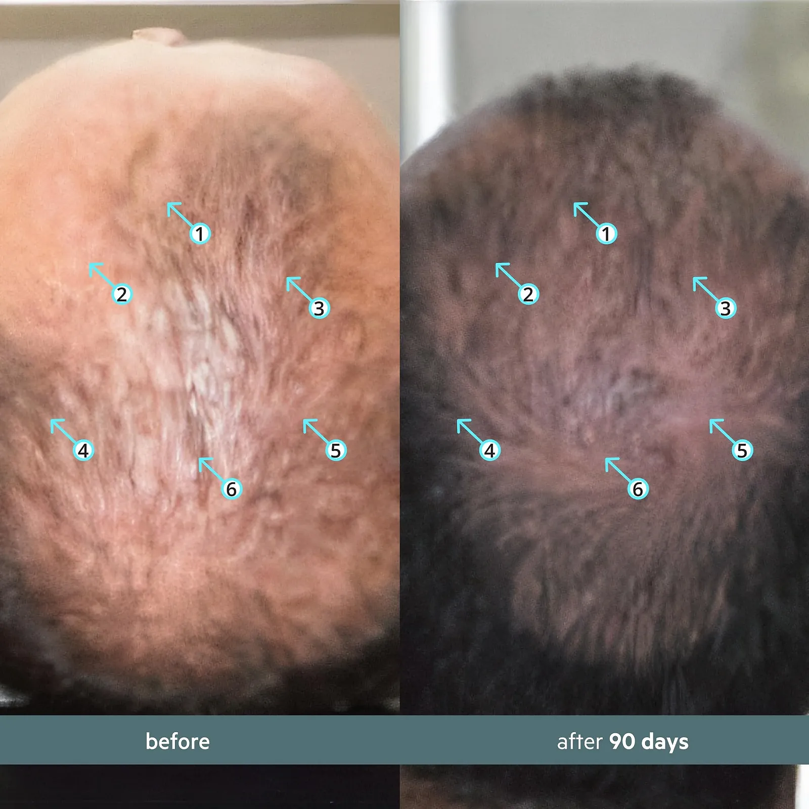 Розчин для місцевого застосування DS Laboratories Spectral.F7 Astressin-B, 60 мл, фото №4