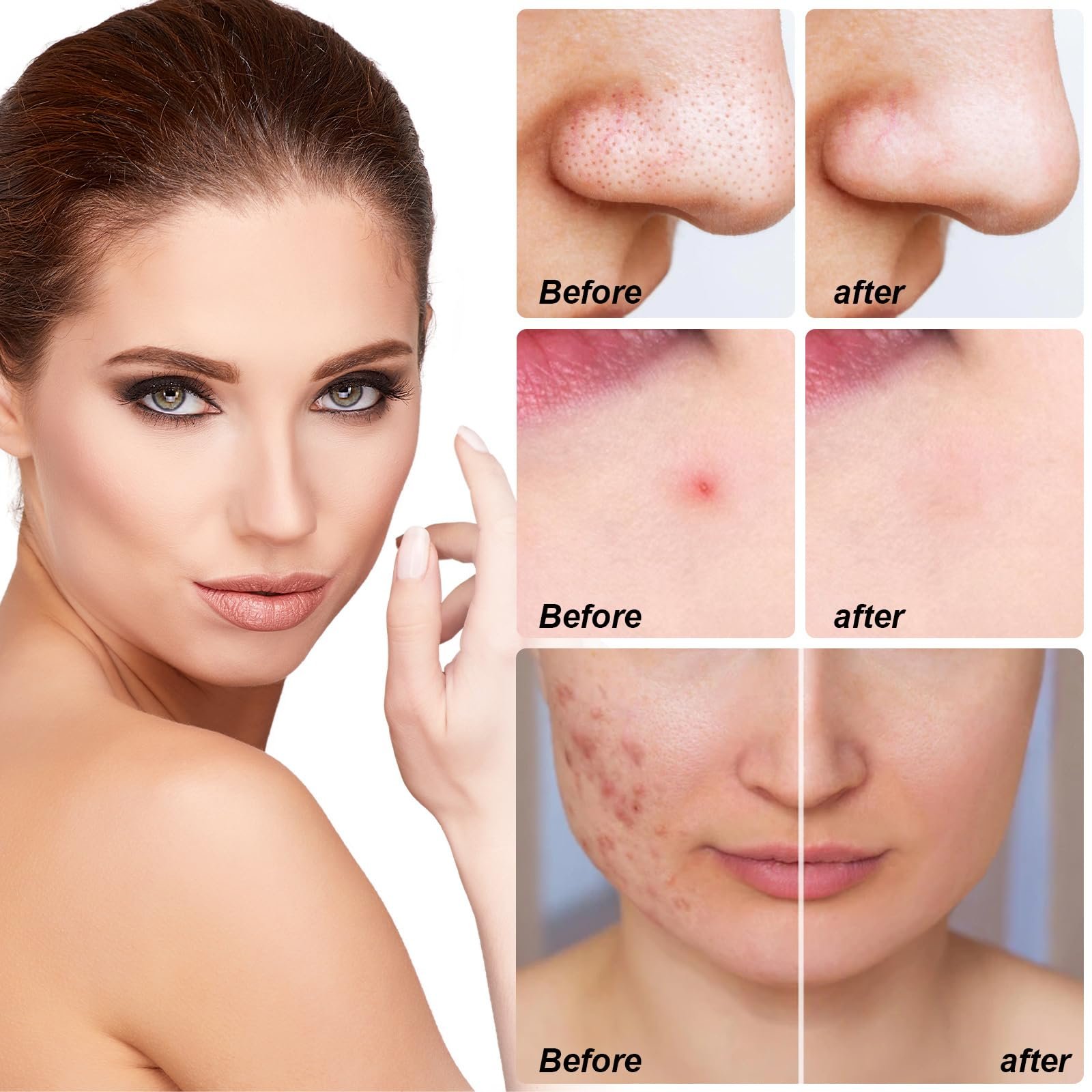 Патчі від прищів Tkekruh, 10 шт., патчі від прищів, потовщені, фото №2