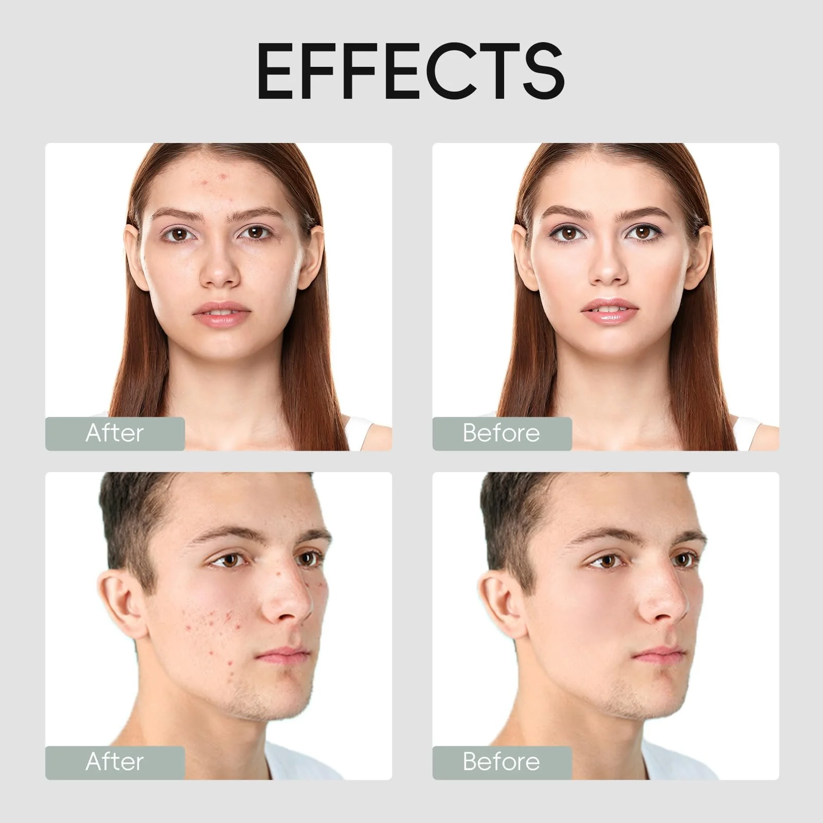 Глиняна Маска LAIKOU для Обличчя Набір глиняних масок для обличчя, 15 штук, фото №4