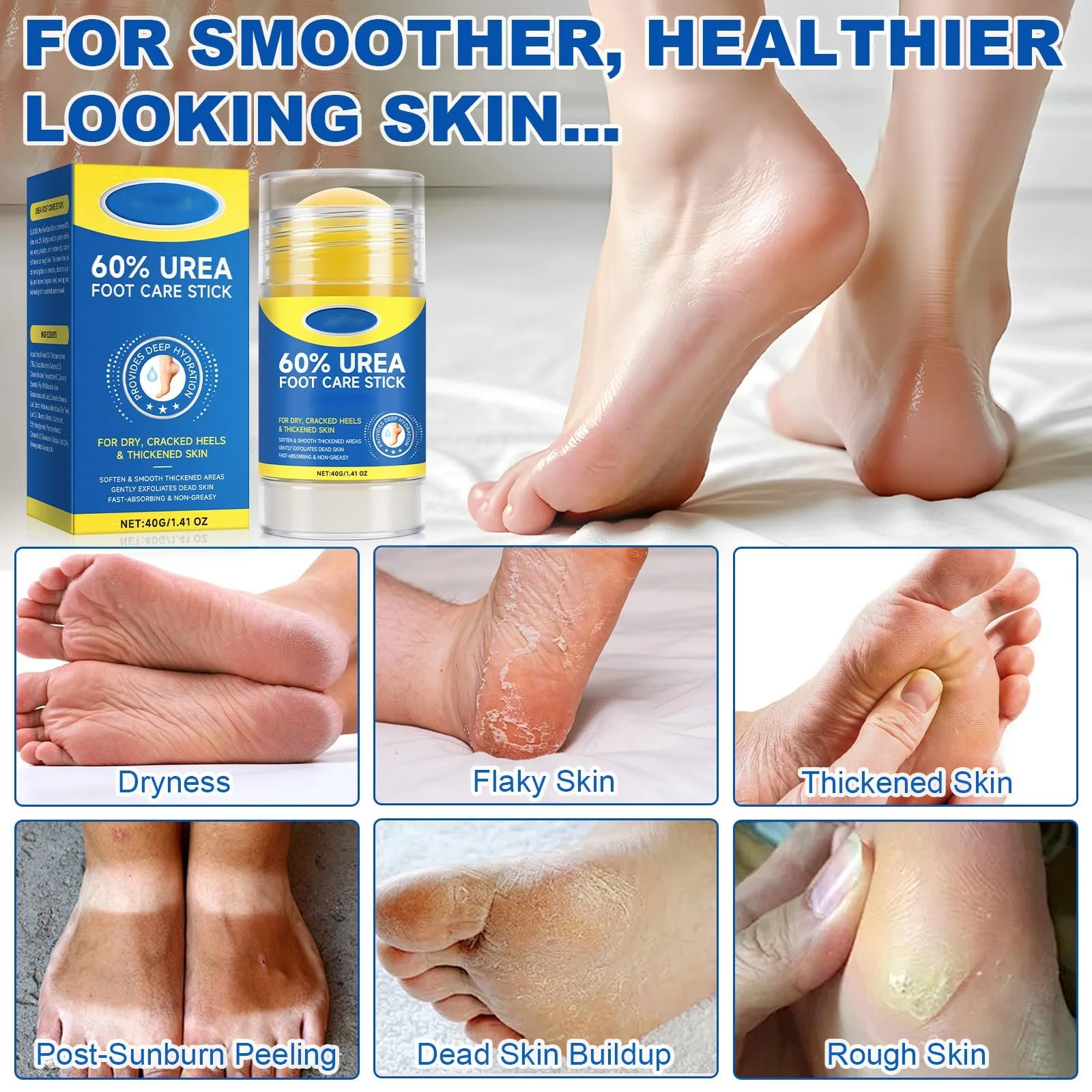 Крем для ног Urea Cream 60% интенсивный от мозолей и трещин в стике, фото №4