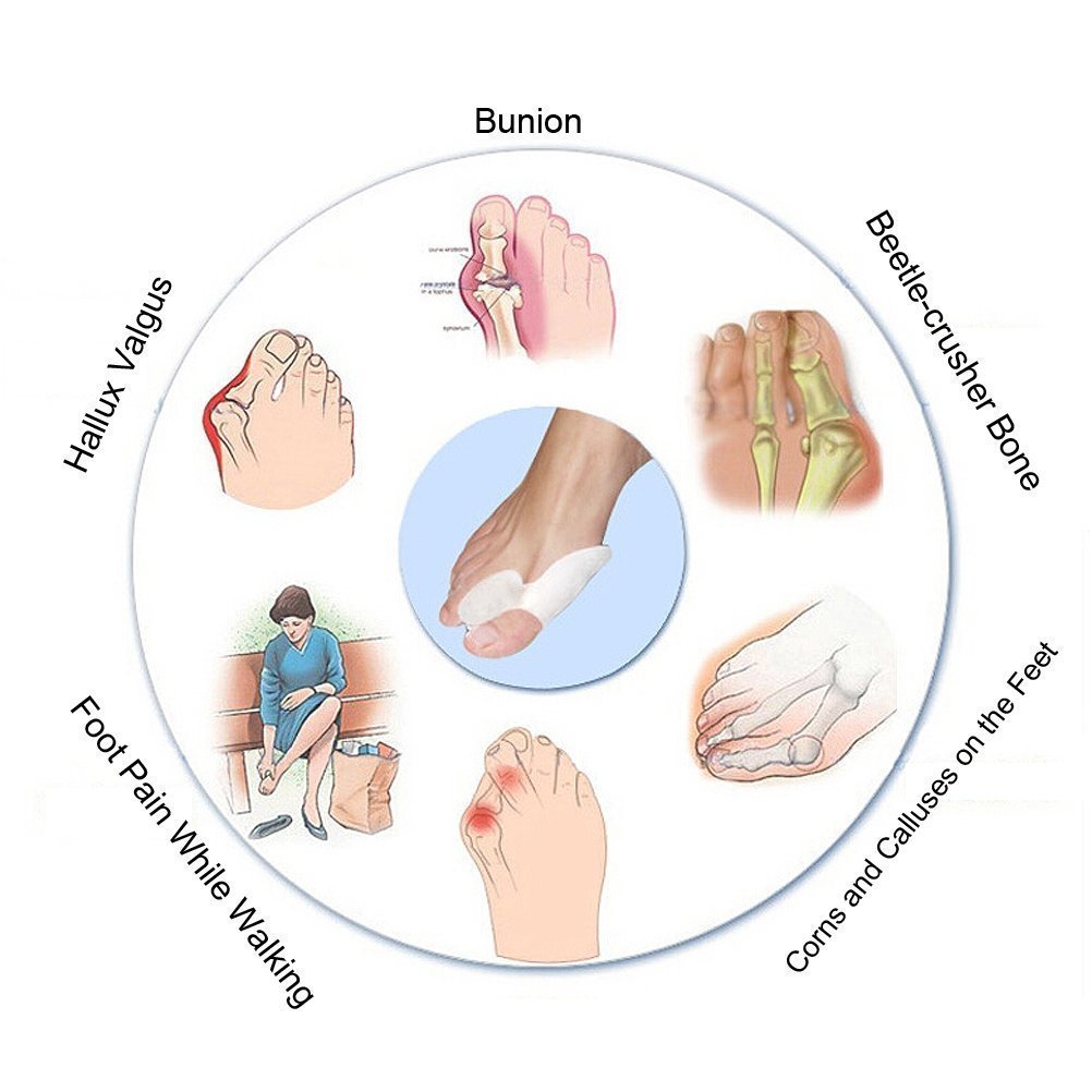 Коректор великого пальця стопи Гелевий 1 пара Білий, фото №4
