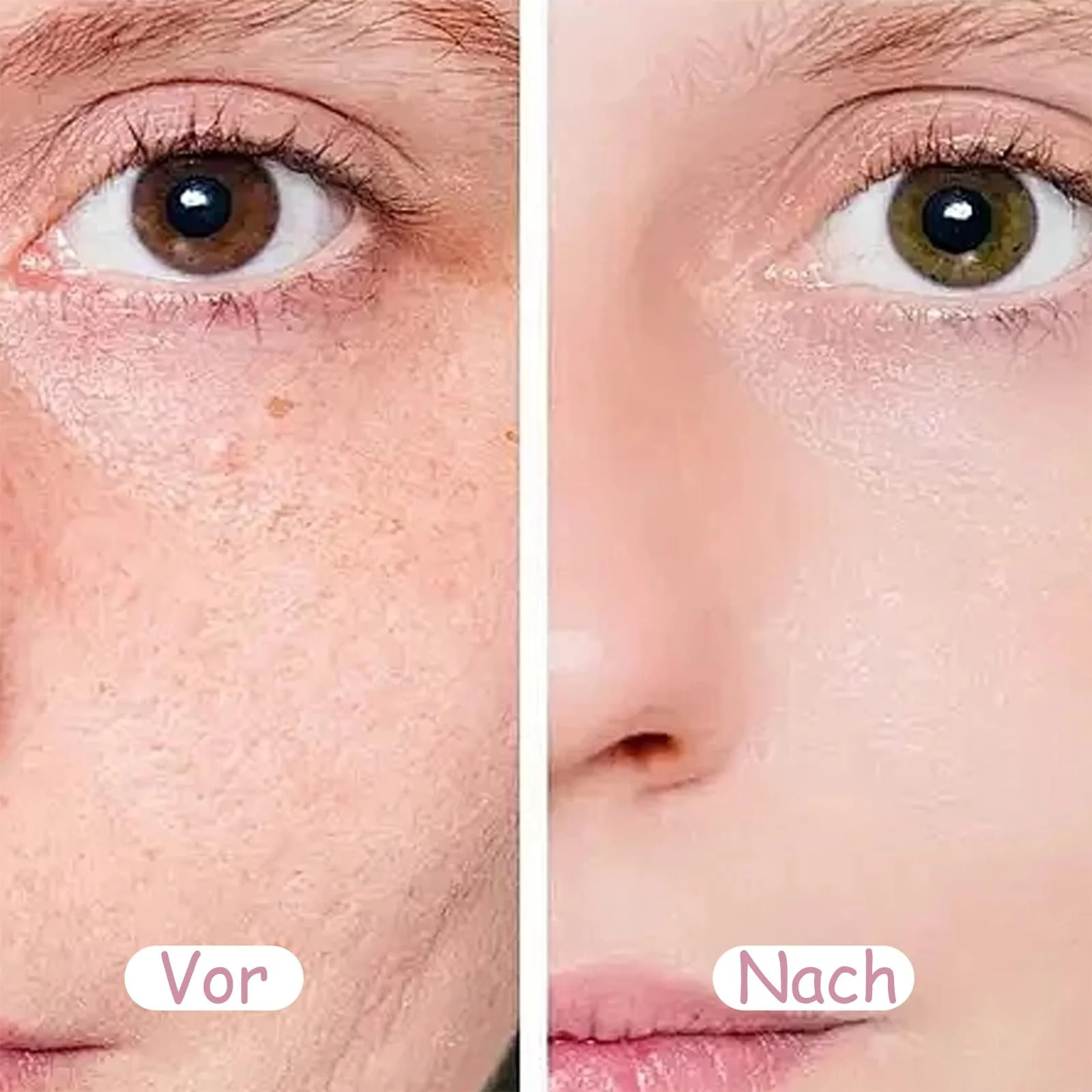 Маска-стик глиняная Centella, 2 шт. Глиняная маска для ухода за кожей, увлажняющая маска для лица с сывороткой Centella для отшелушивания кожи лица, набор для ухода за кожей для уменьшения пор, минимизация пор Centella, фото №6