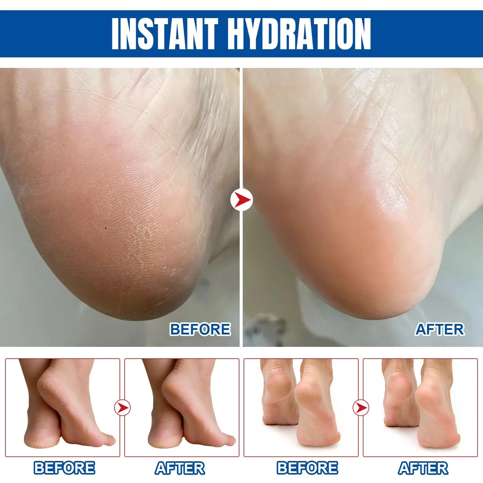 Стик для ухода за ногами 60% Urea Cream and Manuka Honey с 2% салициловой кислотой, фото №5